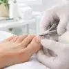 Pėdų priežiūros specialistė žnyplėmis kerpa kojos nagą