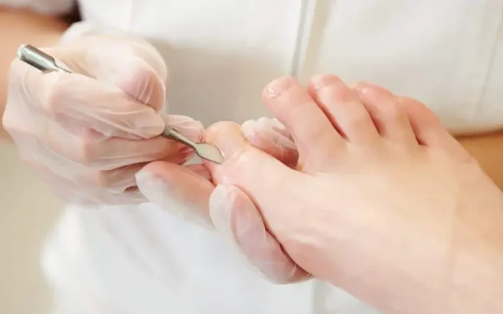 pedicure-curativo-1024x683-1